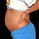 Прерывание беременности во втором триместре Выкидыш на 14 неделе беременности причины